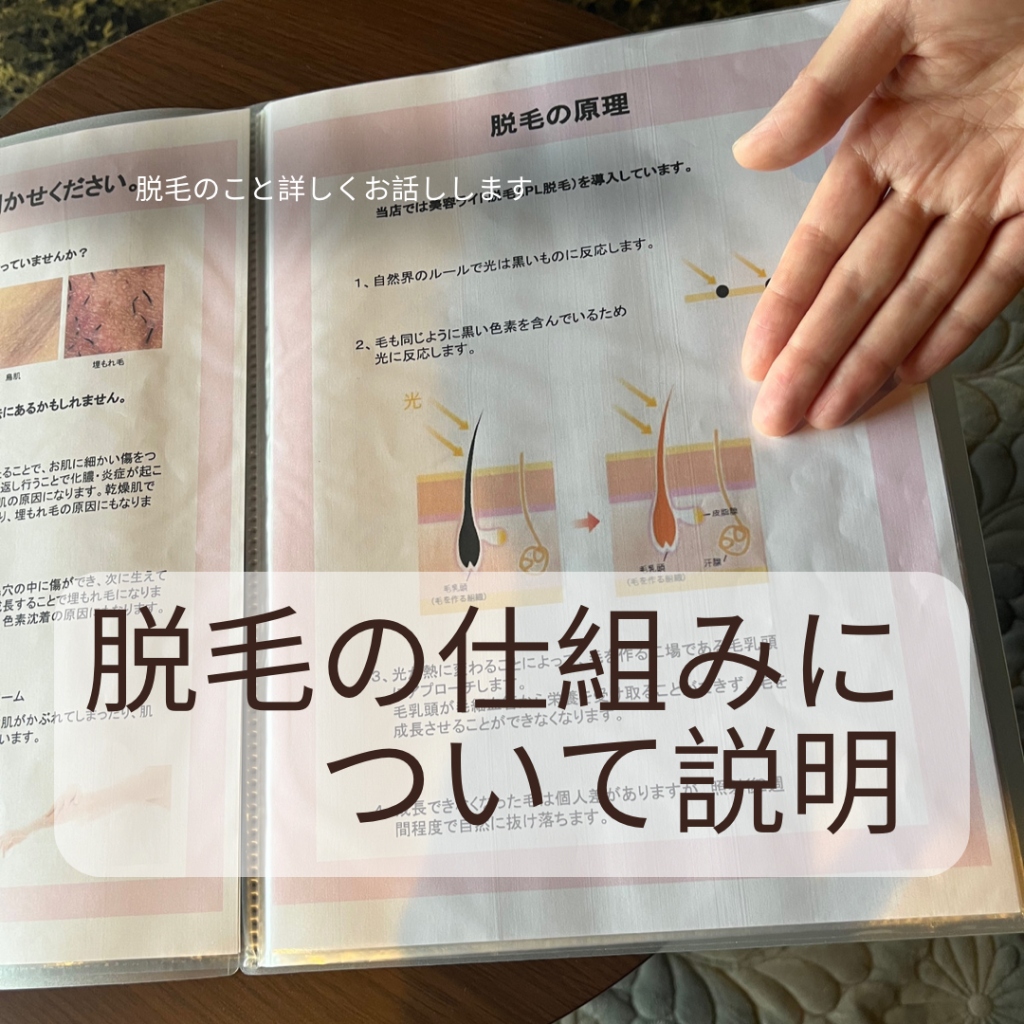 脱毛の仕組み